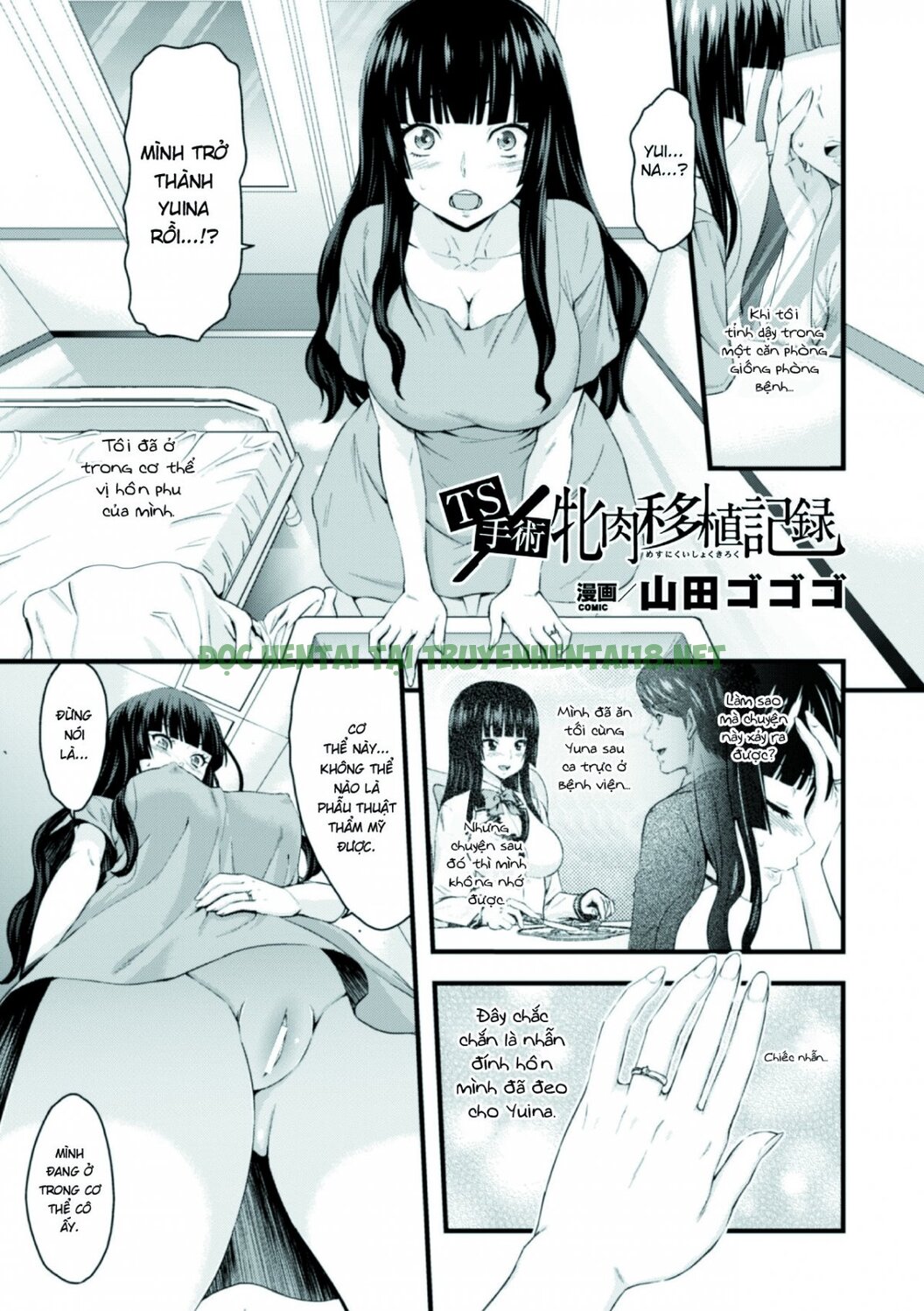 Xem ảnh 1 trong truyện hentai TS Operation File On A Female Body Transplant - One Shot - truyenhentai18.pro
